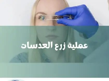 عملية زرع العدسات