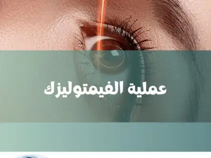 عملية الفيمتوليزك