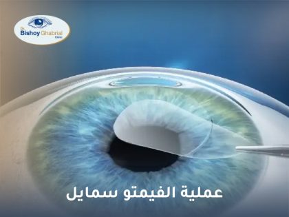 عملية الفيمتو سمايل