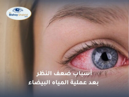 أسباب ضعف النظر بعد عملية المياه البيضاء