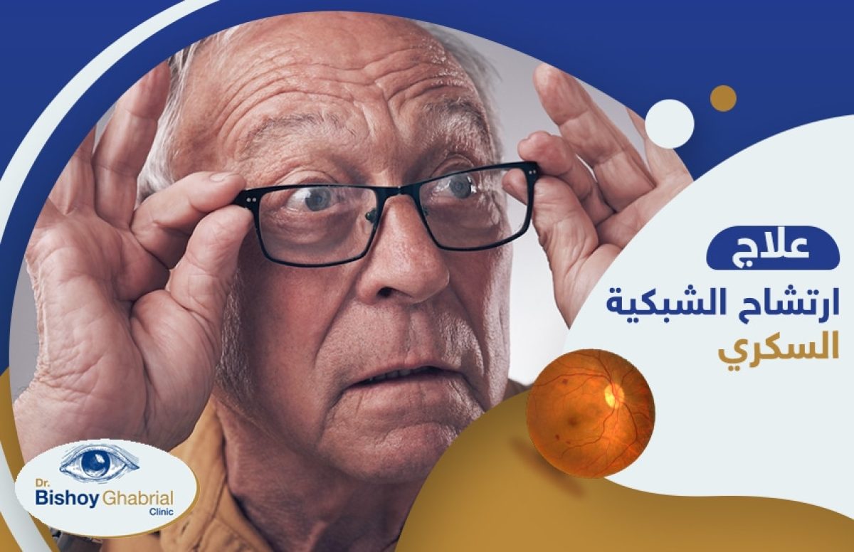 رتشاح-الشبكية-السكري-وعلاجه-عن-طريق-حقن-الشبكية