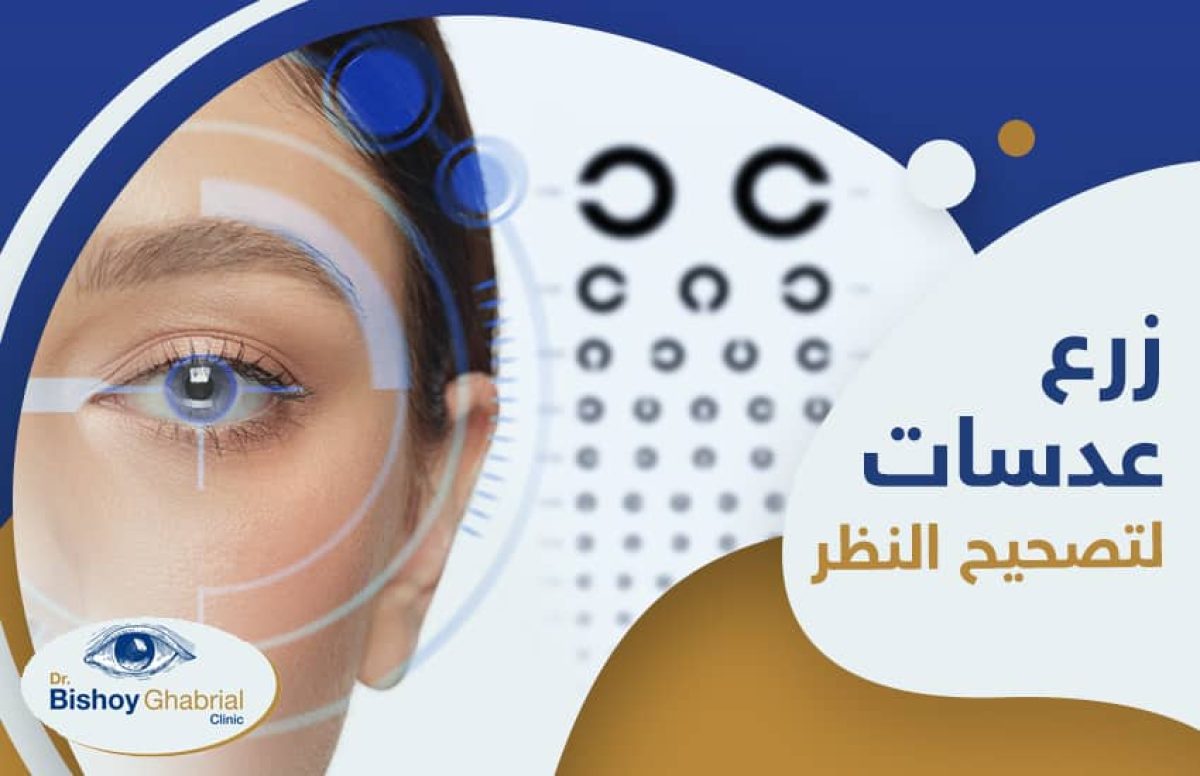 زرع-العدسات-لتصحيح-النظر