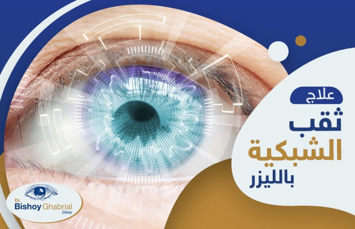 علاج-ثقب-شبكية-العين-بالليزر