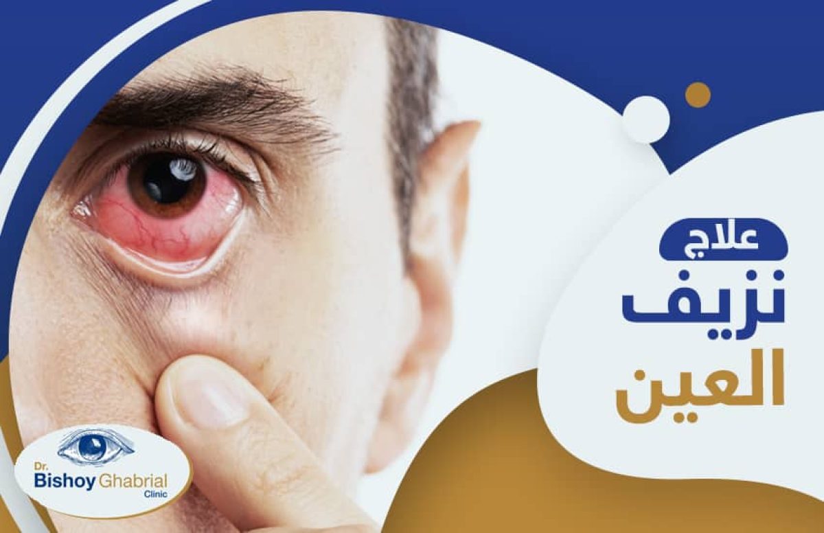 علاج-نزيف-العين-لمرضى-السكر