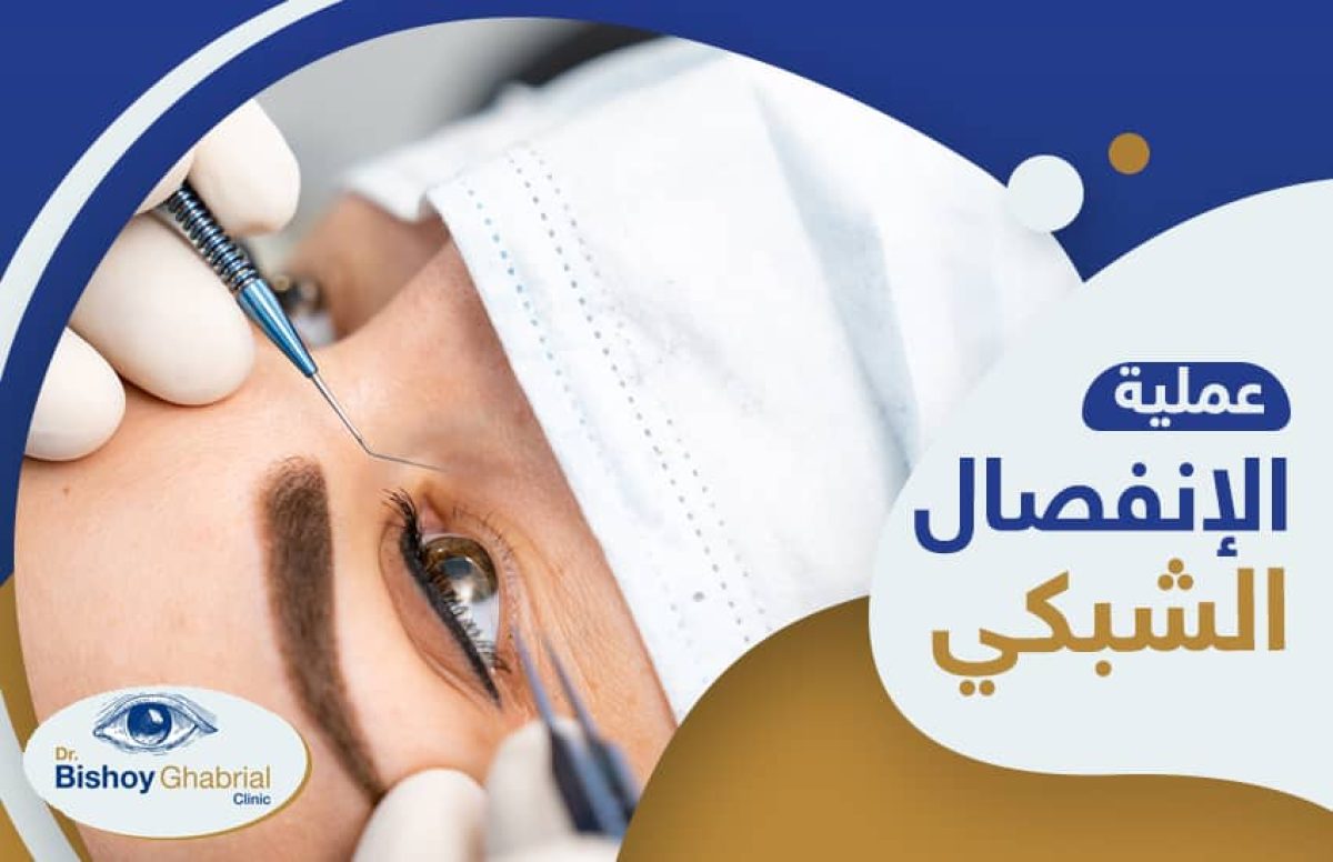 عملية-الإنفصال-الشبكي