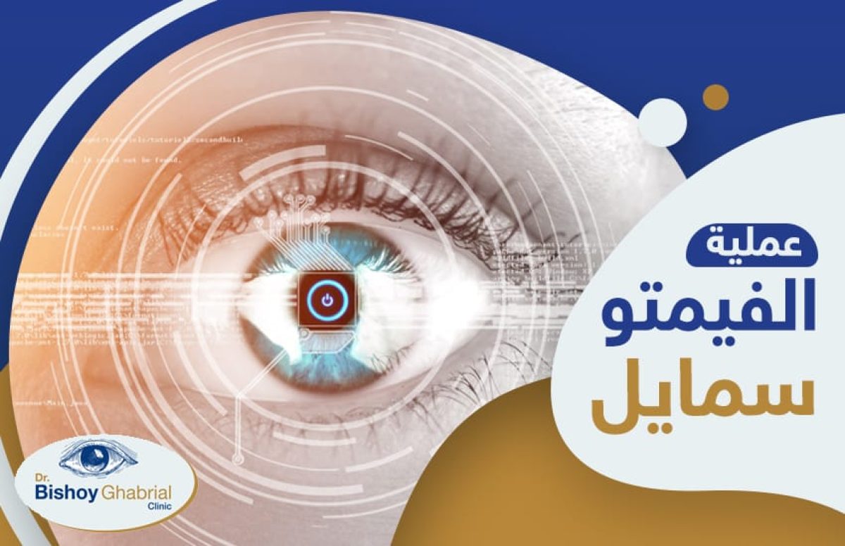 عملية-الفيمتوسمايل
