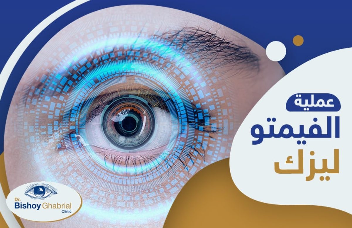 عملية-الفيمتوليزك