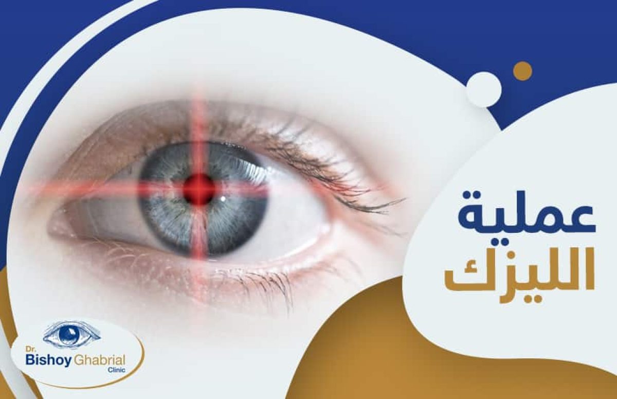 عملية-الليزك
